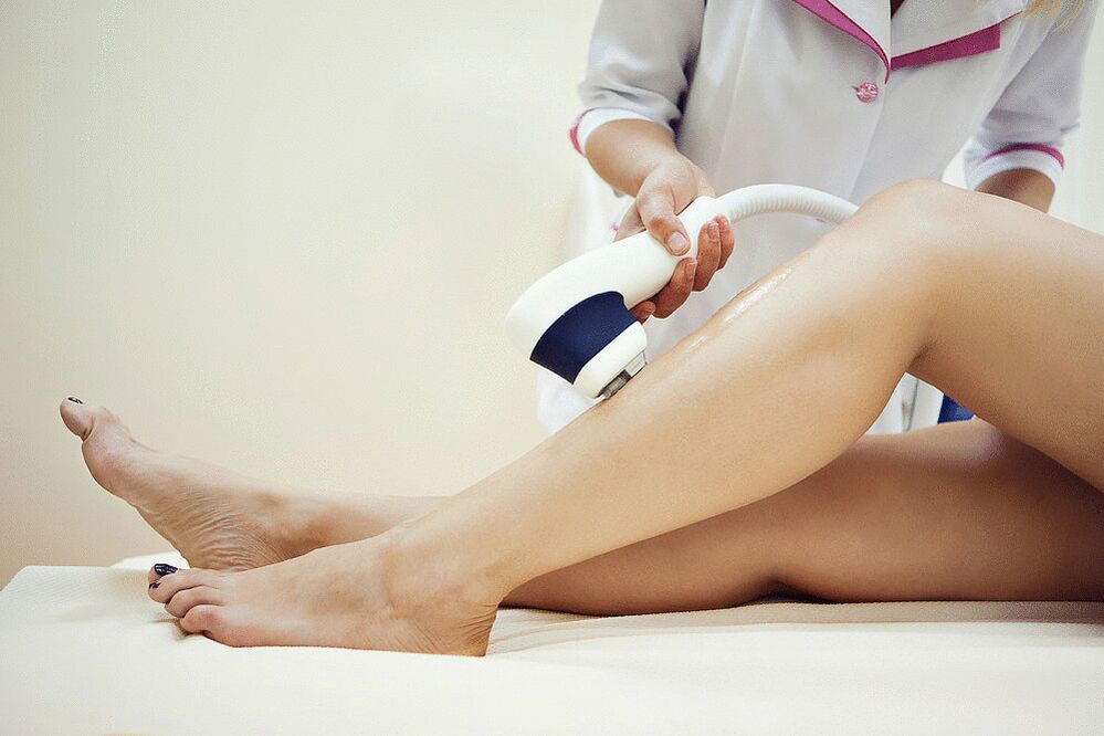 Prefate pour les varices